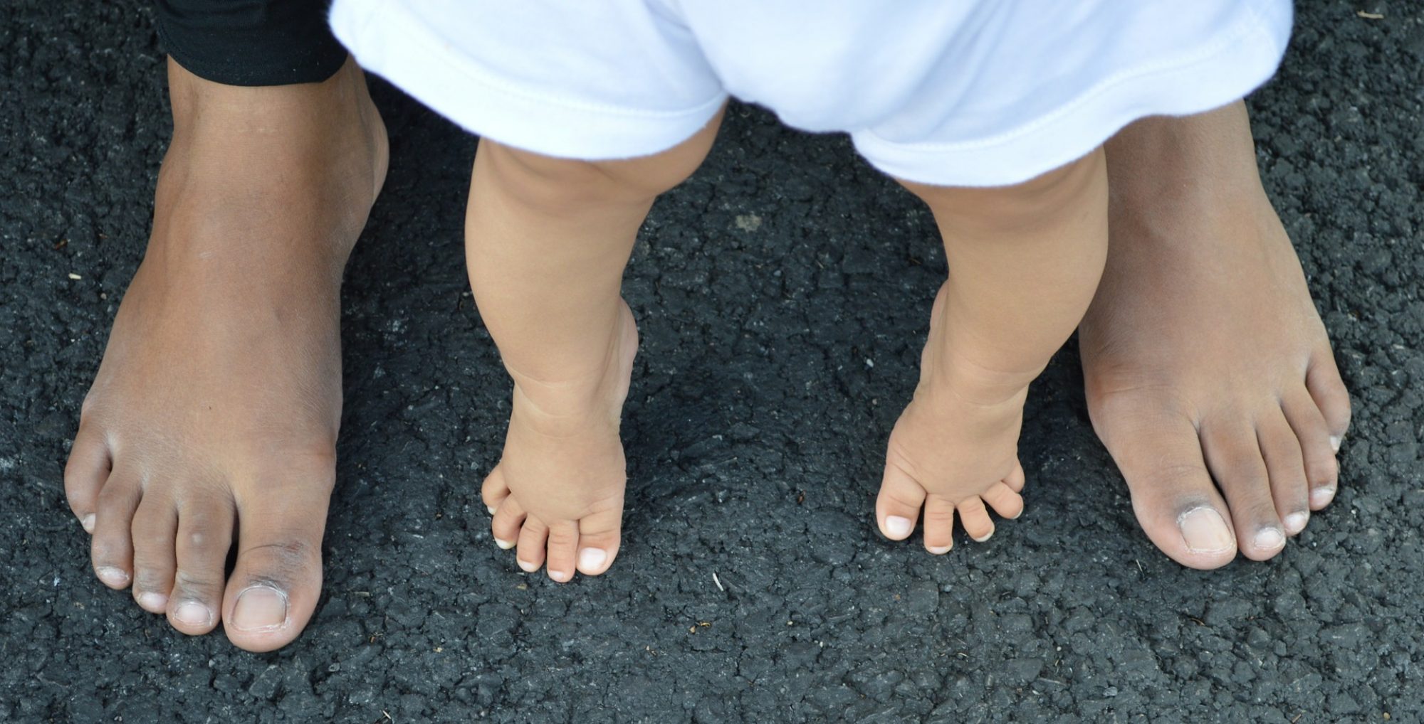 Foot week. Массаж при вальгусной деформации стопы у детей. Feet week.
